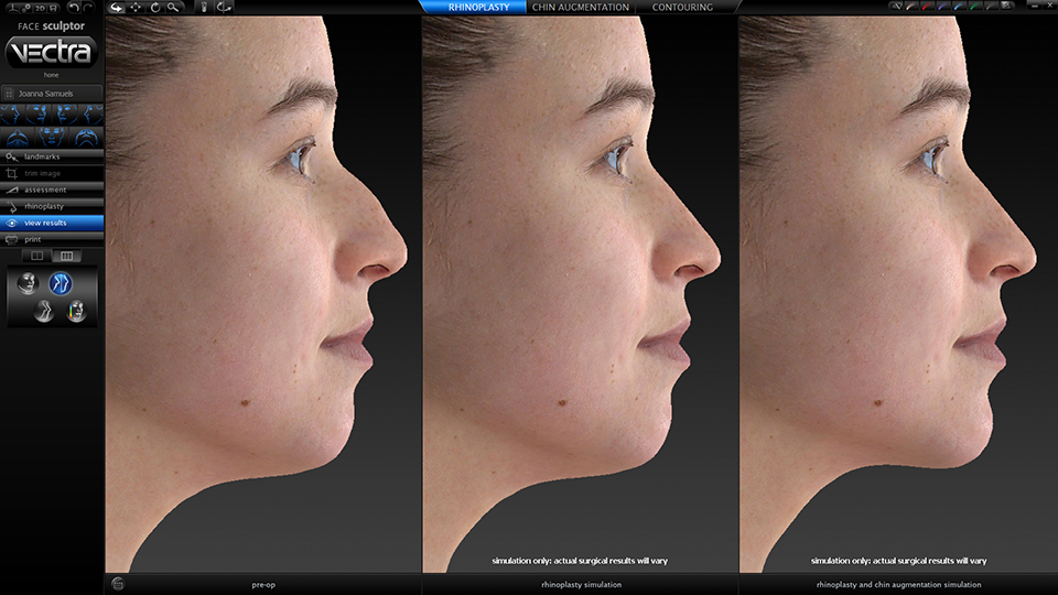 FaceSculptor rhino chin review RGB