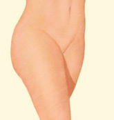 liposuction areas results