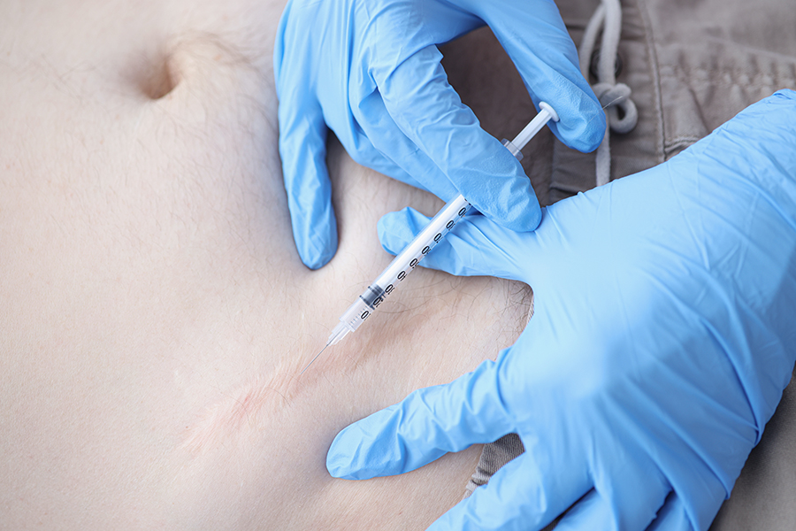 Gloved Doctor Injects The Keloid Scar