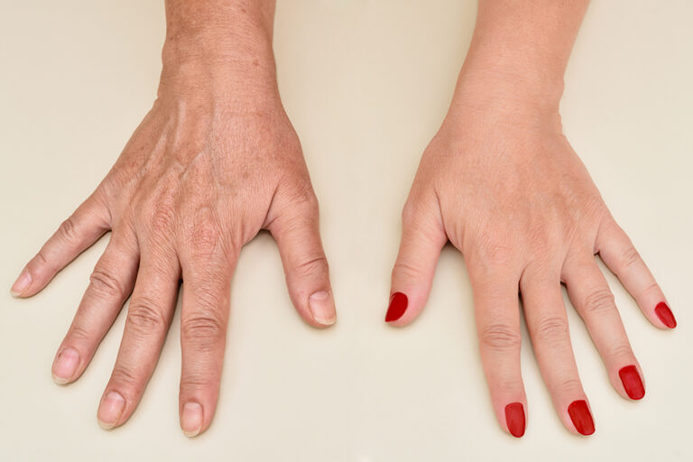 Is It True Your Hands Can Tell Your Age?