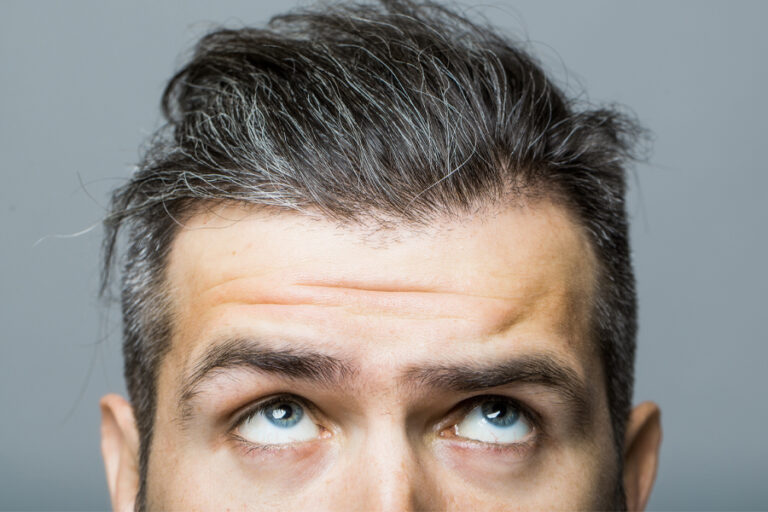 Botox® Cosmetic Is For Men Too!