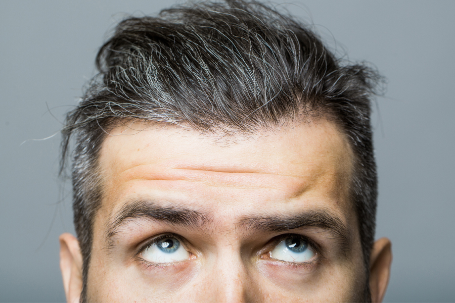 Male Face With Forehead Wrinkles