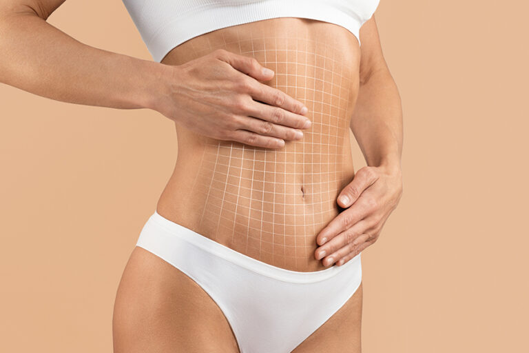 Liposuction: Sculpt Your Body With Precision