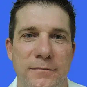 Laser Skin Resurfacing before and after photos