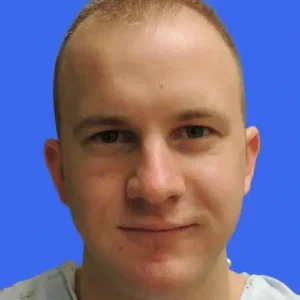 Neograft Hair Loss Replacement before and after photos