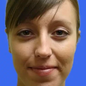 Ear Surgery before and after photos