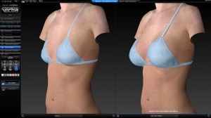 Vectra 3D Imaging Technology Used By Des Moines Plastic Surgery