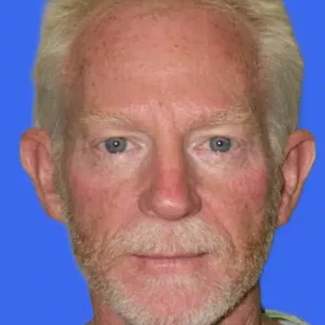 Ear Surgery before and after photos