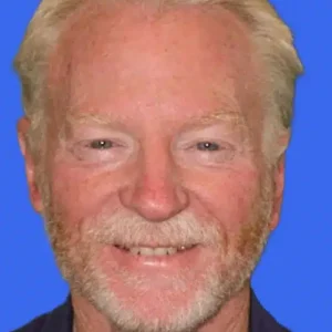 Ear Surgery before and after photos