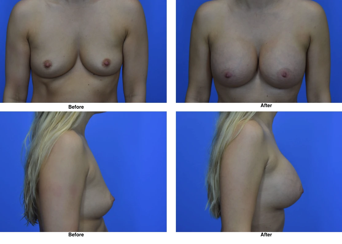 Before and After by Dr David Robbins