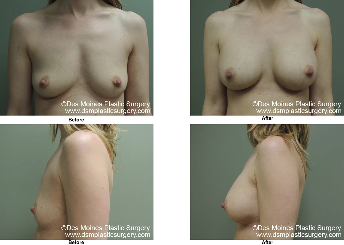 Before and After by Dr David Robbins