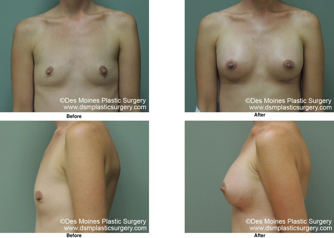 Before and After by Dr David Robbins