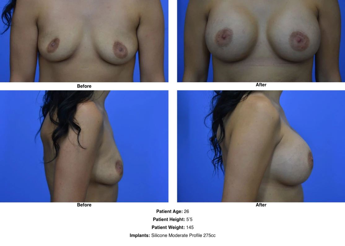 Before and After by Dr David Robbins