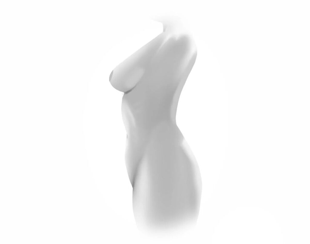 Tummy Tuck Surgery 2 Tummy Tuck After Results