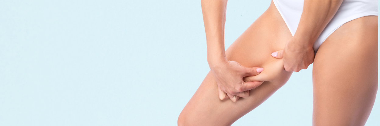 Thigh Lift