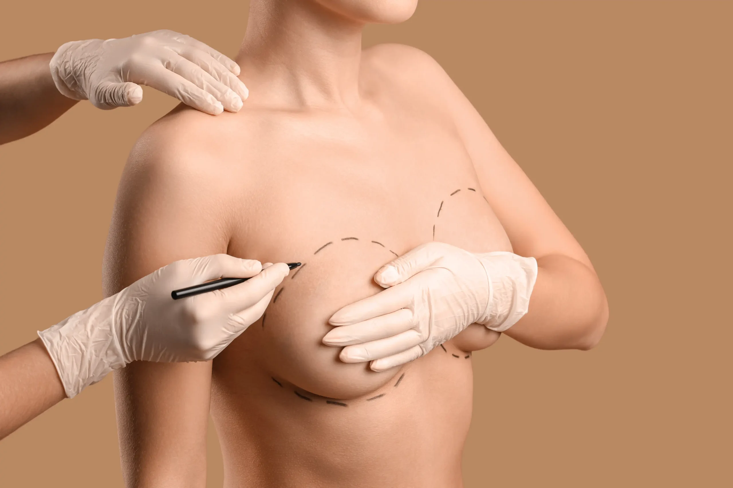 Breast Augmentation Surgery