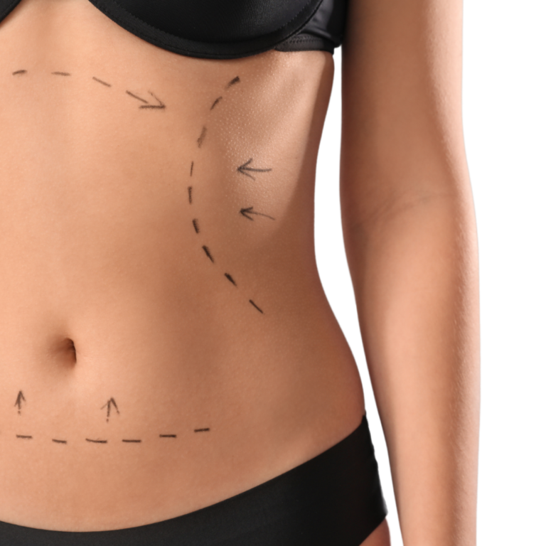 How to Choose the Best Abdominoplasty Surgeon for Safe, Natural-Looking Tummy Tuck Results 