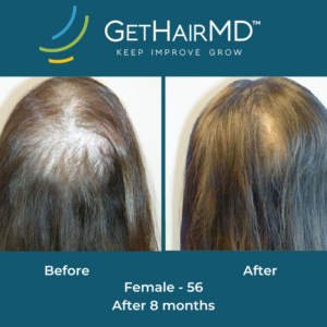 gethairmd