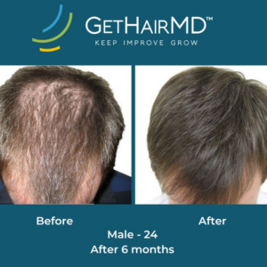 gethairmd