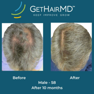 gethairmd