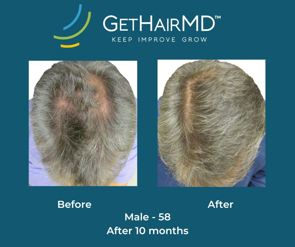 gethairmd