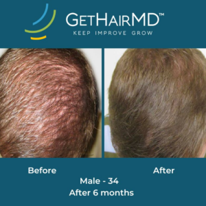 gethairmd