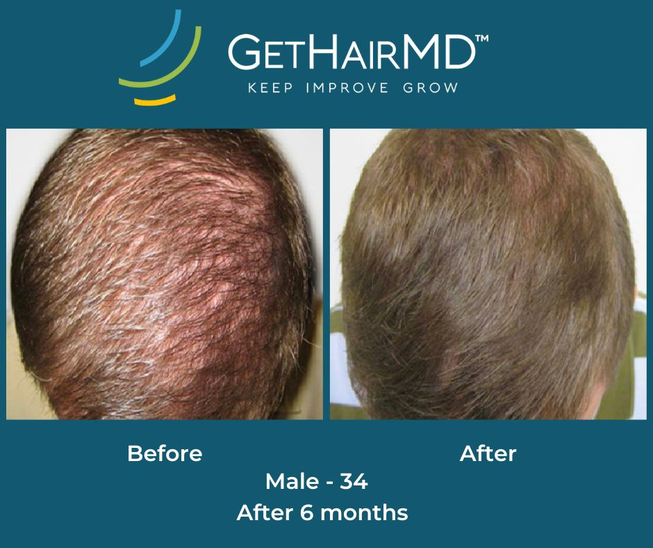 gethairmd