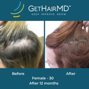 gethairmd