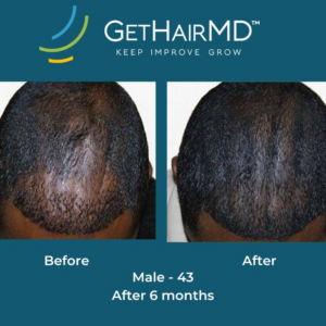 gethairmd