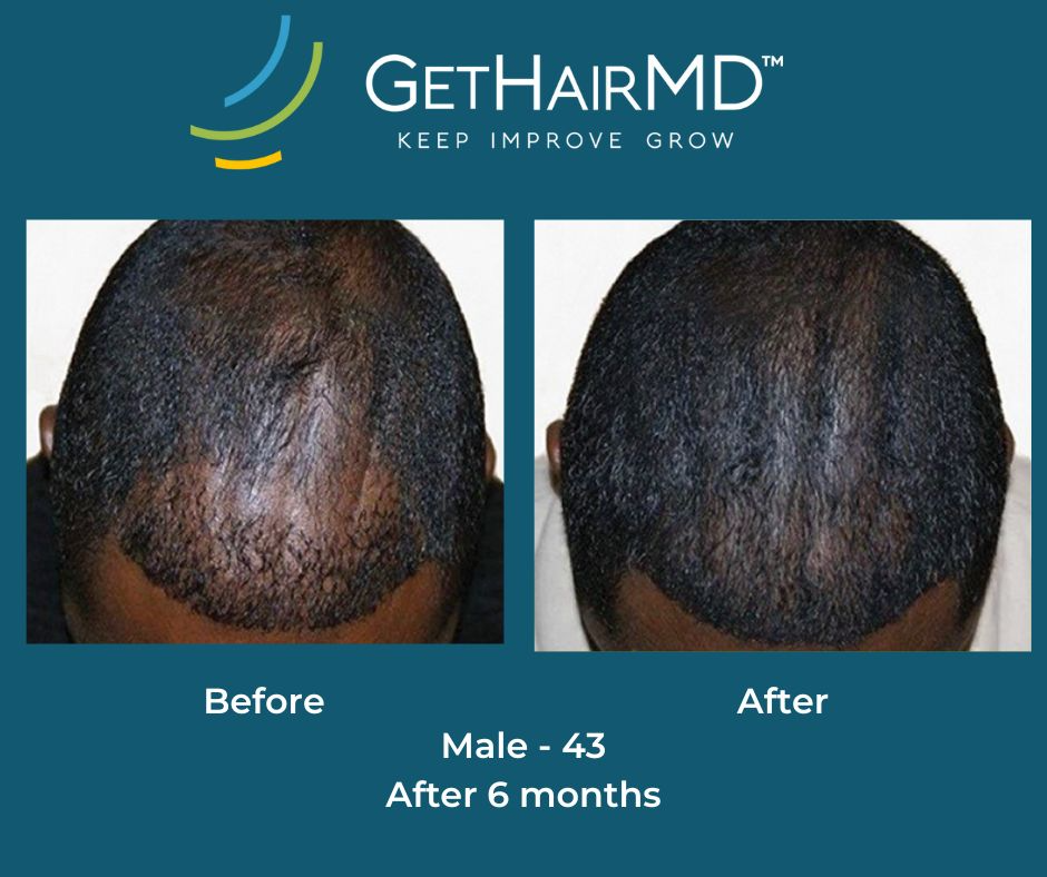 gethairmd