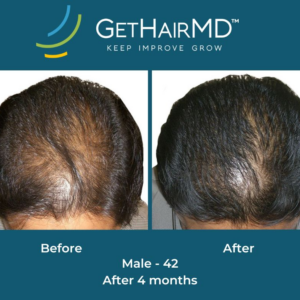 gethairmd