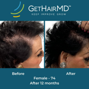 gethairmd