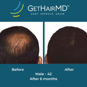gethairmd