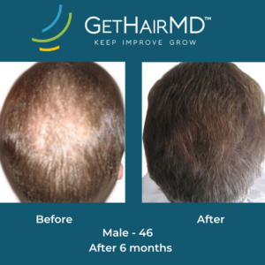 gethairmd
