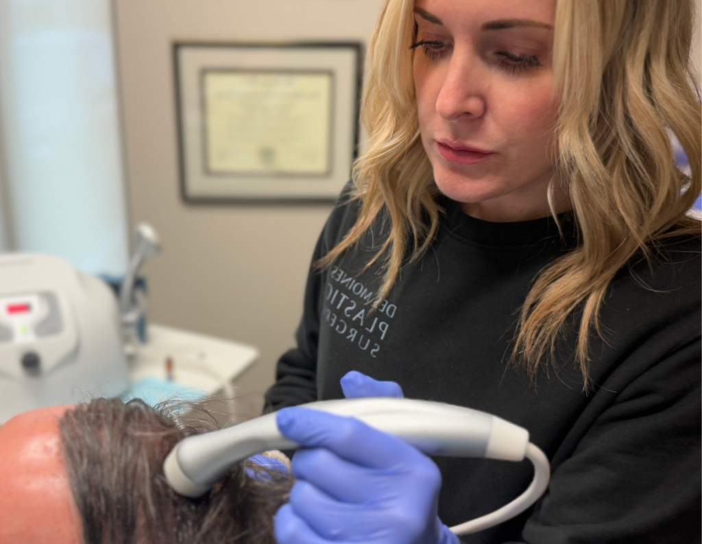 Gethairmd 15 Follicular Infusion