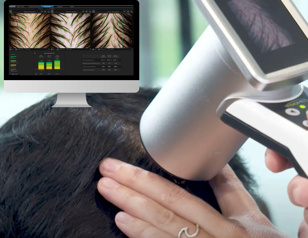 Gethairmd 16 Hairmatrix