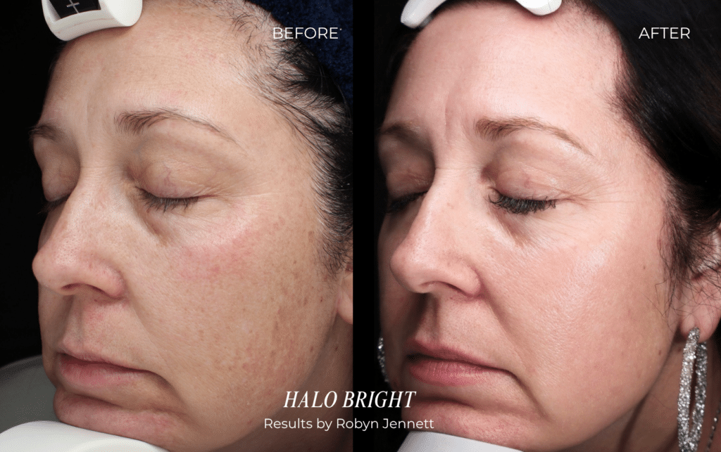 HALO BRIGHT before and after